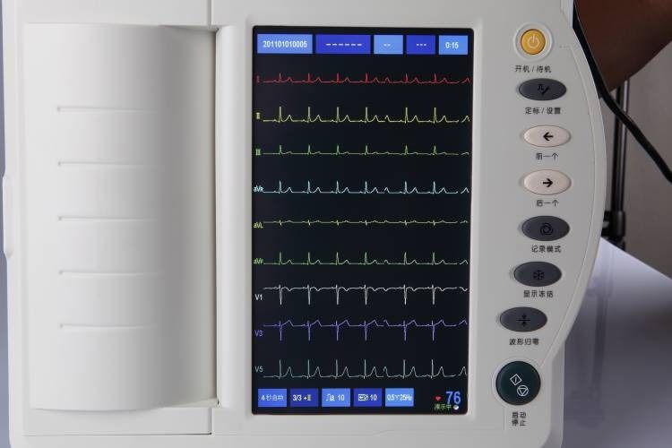 Exame cardíaco por máquina de ECG humano Cardiologia Máquina de ECG de 12 canais Máquina de ECG de eletrocardiograma Máquina de ECG