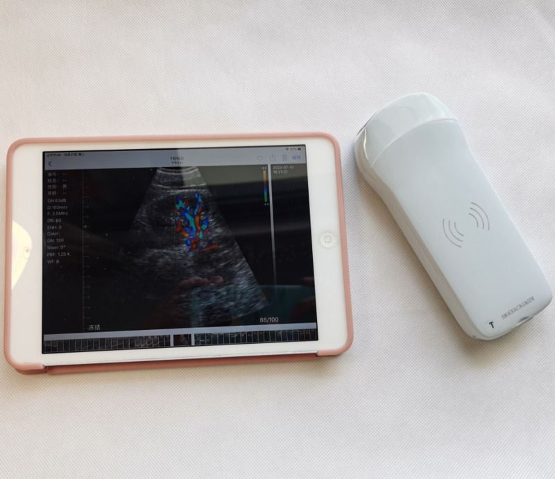 Usg New Look Imagem 3d GYN Imagem Laptop Ob Gyn Fetais máquina de ultra-som Doppler de cor com alta qualidade