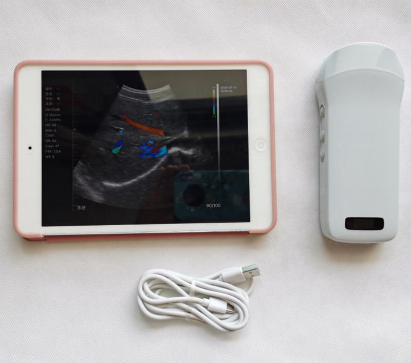 Usg New Look Imagem 3d GYN Imagem Laptop Ob Gyn Fetais máquina de ultra-som Doppler de cor com alta qualidade
