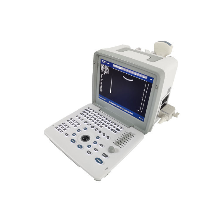 Metal Ver Laptop B W Portátil Gravidez Doppler Probe Scanner Rádio Feto Máquina de Ultrassonografia Para Bebê