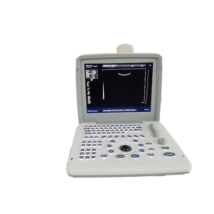 Metal Ver Laptop B W Portátil Gravidez Doppler Probe Scanner Rádio Feto Máquina de Ultrassonografia Para Bebê