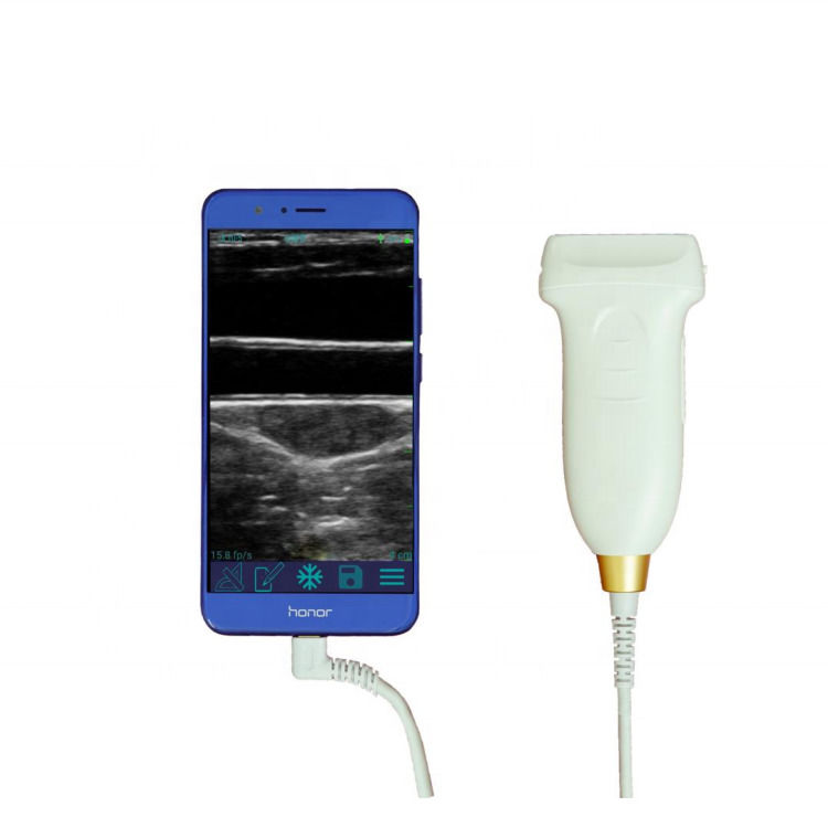 Sonda de ultrassom GYN 3 em 1 usb wifi sondas de ultrassom convexas sem fio para android