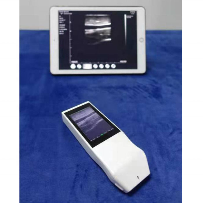 WIFI Wireless Color Probe GYN Ultrasound Linear Probe With Display Anestesia Puncture Navigation Ultrasound de mão