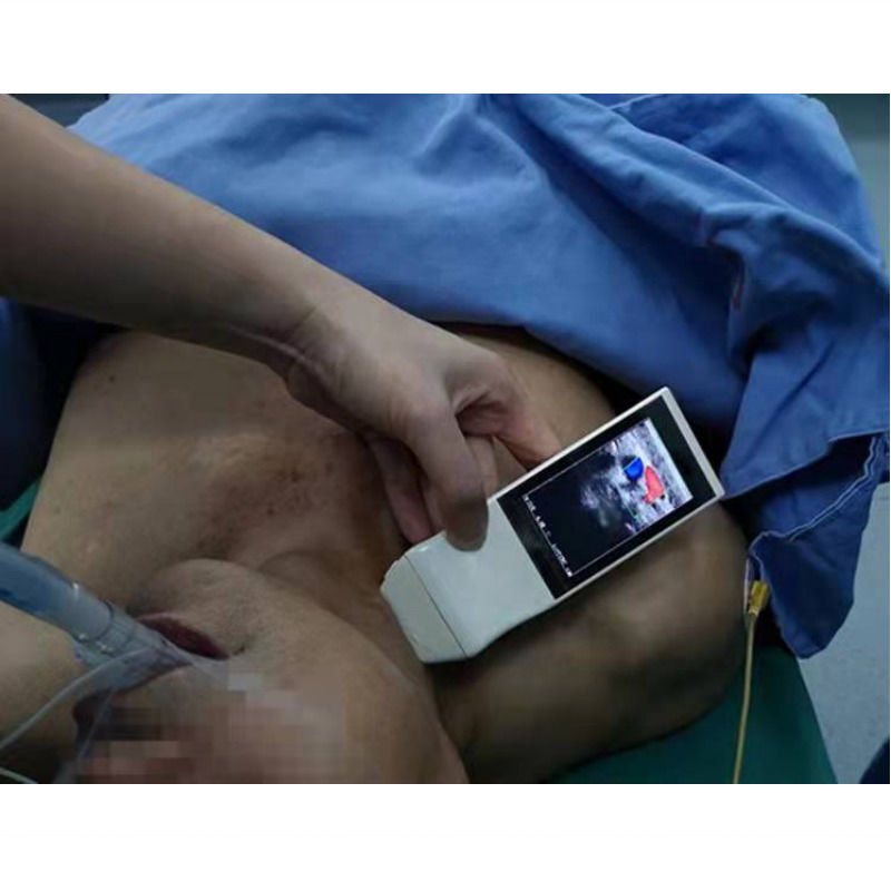 WIFI Wireless Color Probe GYN Ultrasound Linear Probe With Display Anestesia Puncture Navigation Ultrasound de mão