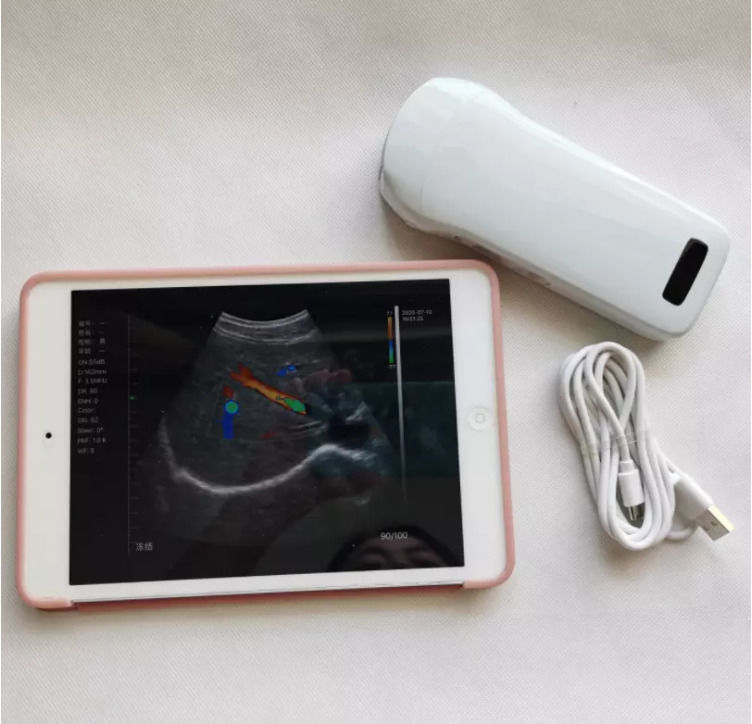 GYN Ultrassonografia Instrumentos sem fio sonda clínica portátil Instrumentos analíticos máquina de ultrassom móvel