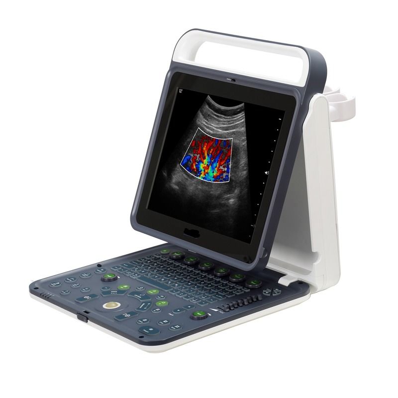 Hospital fora 2020 Nova máquina portátil digital de 15 polegadas de ultrassom Doppler a cores