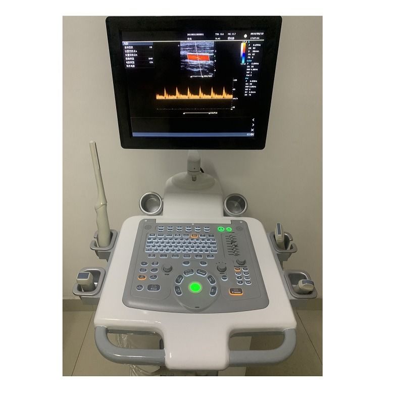 O hospital fora do carrinho 15 polegadas máquina de ultra-som ultra-som digital cor Doppler máquinas de ultra-som édical