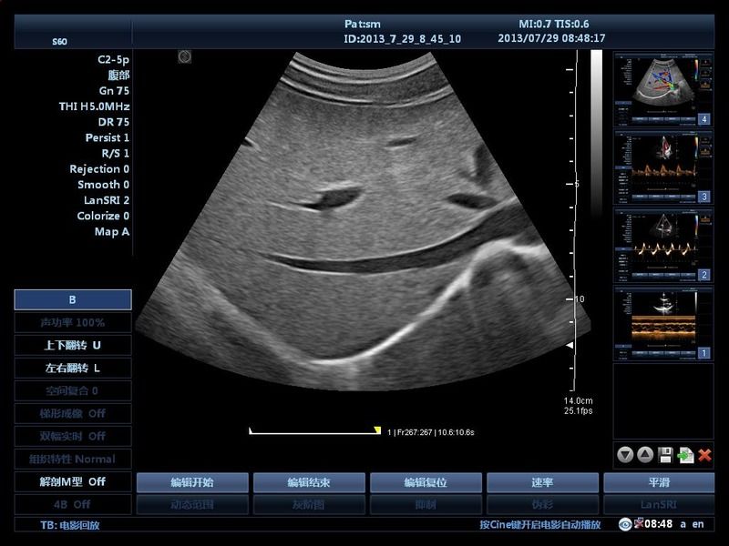 O hospital fora do carrinho 15 polegadas máquina de ultra-som ultra-som digital cor Doppler máquinas de ultra-som édical