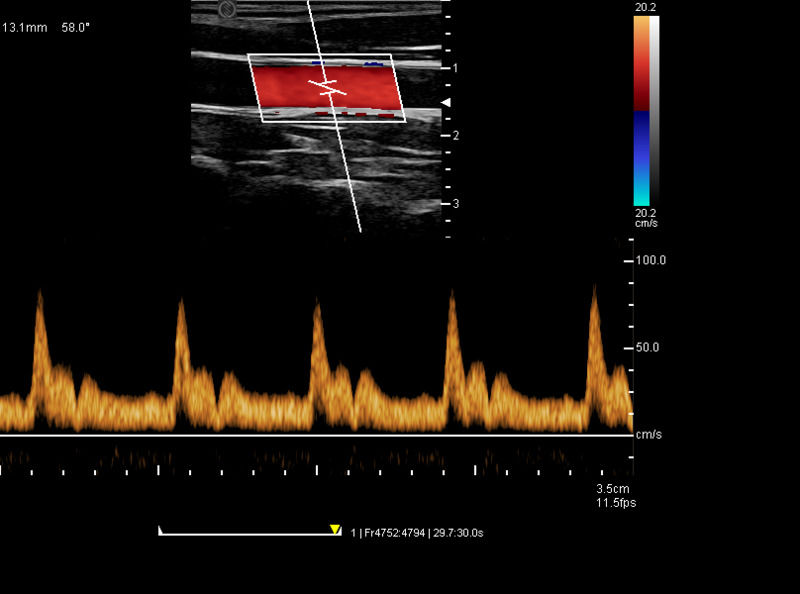 China Cart Digital Color Doppler Ultrassom Máquina de Ultrassom Médico Ultrassom Hospitalar Exterior
