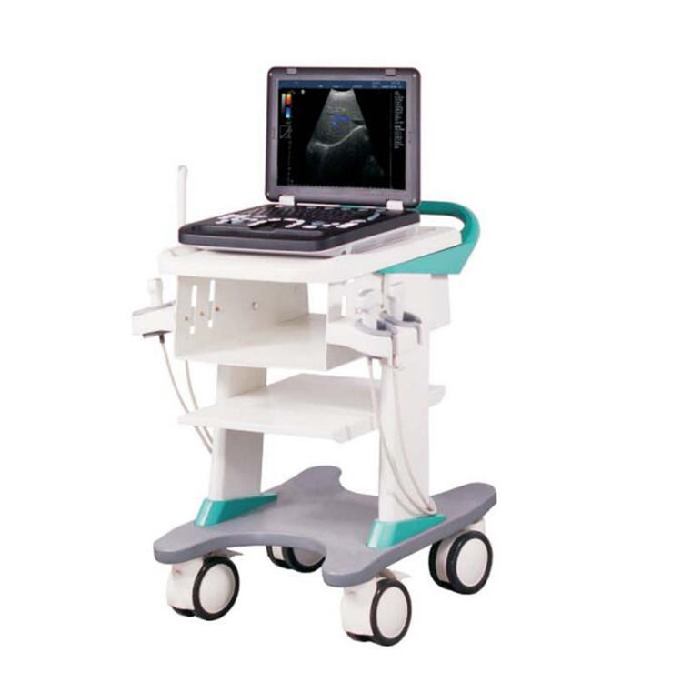 100% Garantida Máquina portátil de ultra-som Doppler de cor Ecocardiografia Eco Ultrassom