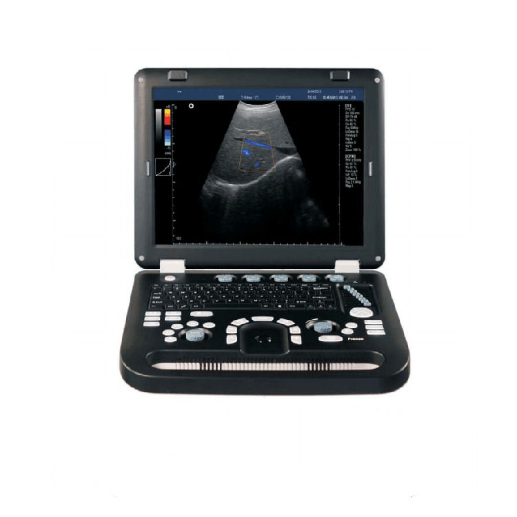 100% Garantida Máquina portátil de ultra-som Doppler de cor Ecocardiografia Eco Ultrassom