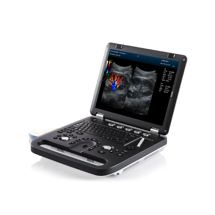 100% Garantida Máquina portátil de ultra-som Doppler de cor Ecocardiografia Eco Ultrassom