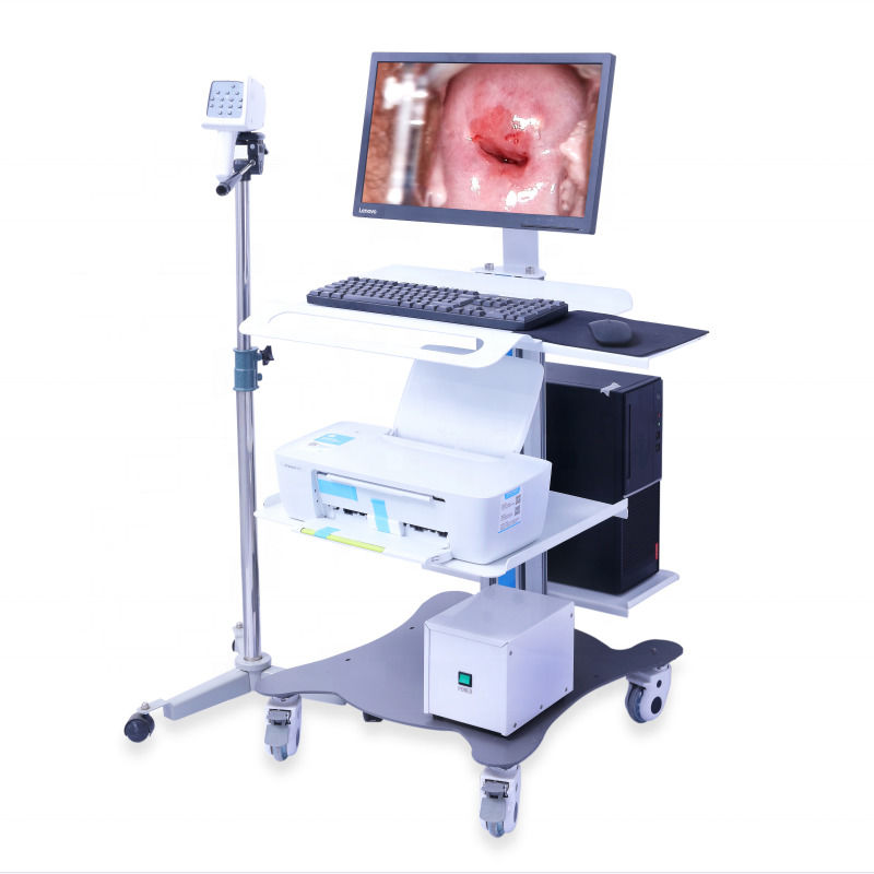 Colposcópio GYN portátil Sistema de Imagem Digital do Colposcópio Exame Vaginal Vídeo Colposcópio para Ginecologia