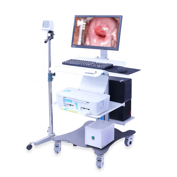 Colposcópio GYN portátil Sistema de Imagem Digital do Colposcópio Exame Vaginal Vídeo Colposcópio para Ginecologia