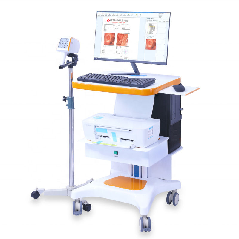 Colposcópio GYN portátil Sistema de Imagem Digital do Colposcópio Exame Vaginal Vídeo Colposcópio para Ginecologia